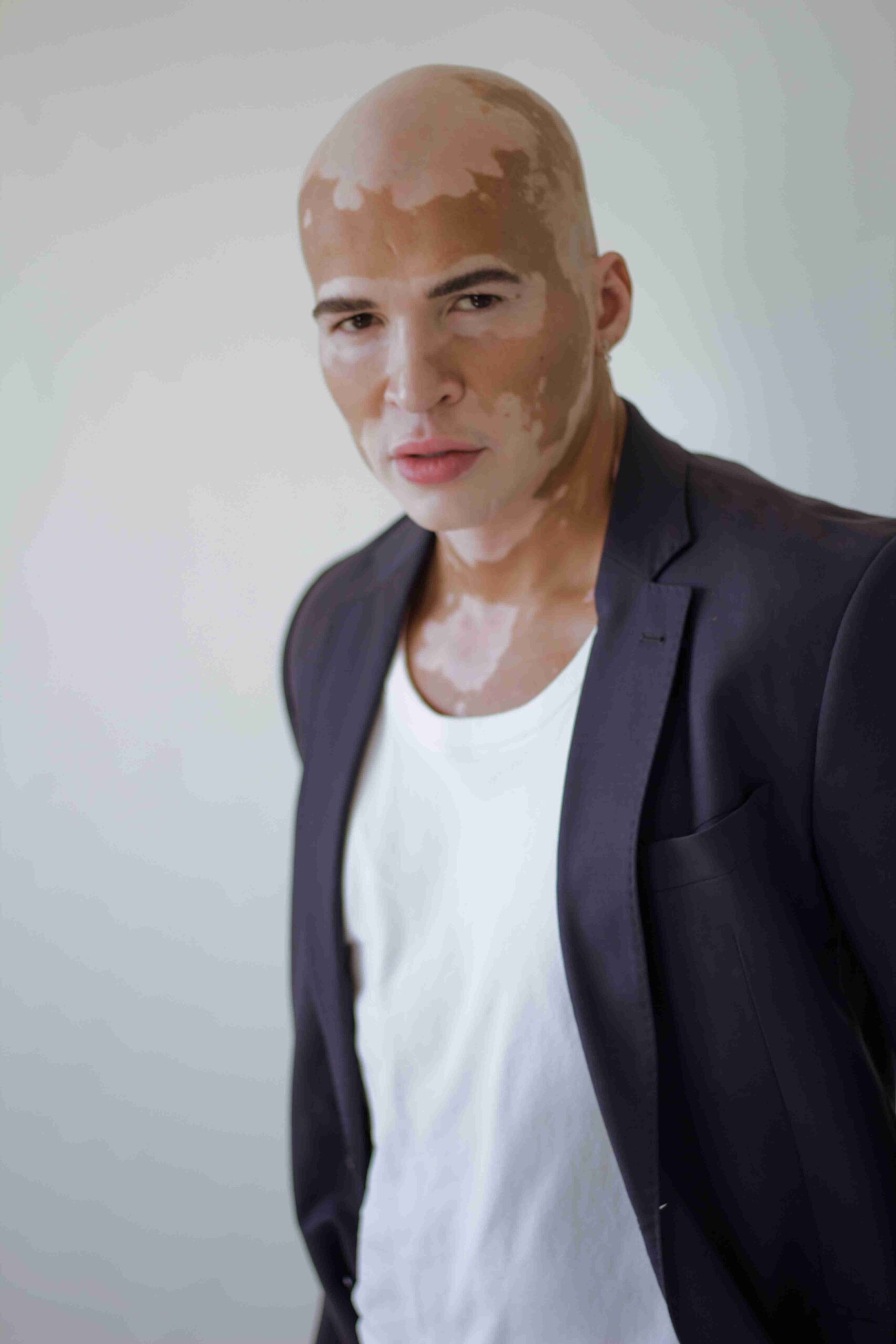 Roger Monte - Front Management